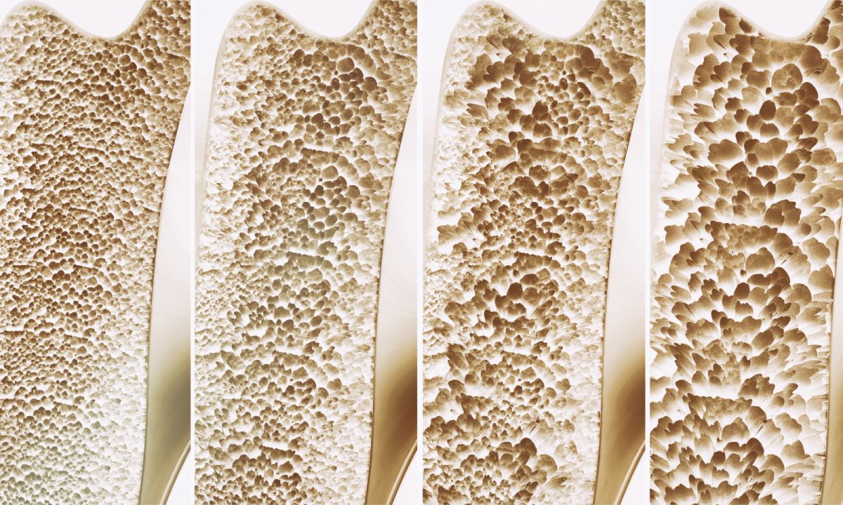 bone density and muscle strength